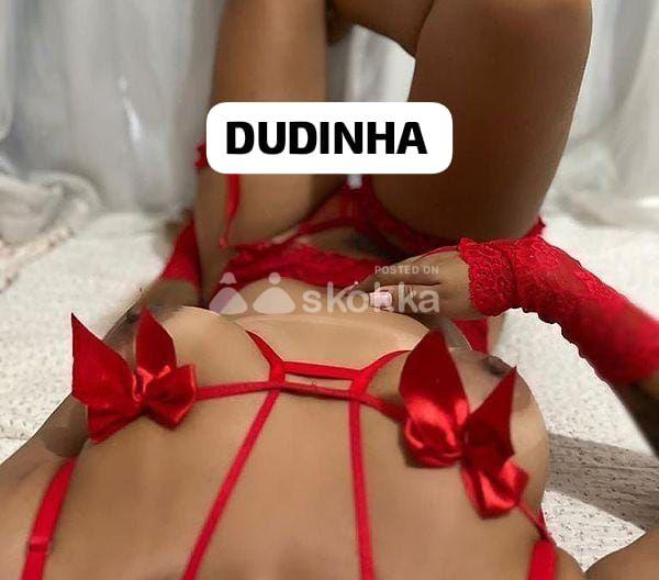 Foto do anúncio Dudinhaa